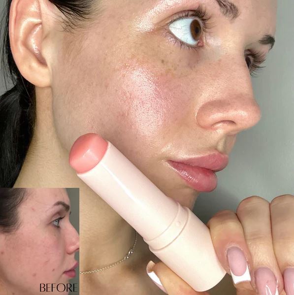 GlowLift™ – Bálsamo de Colágeno Reafirmante y Antiedad