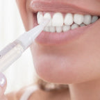 Smile White™ — El Lápiz Blanqueador 4X Más Potente (Promo 2x1)
