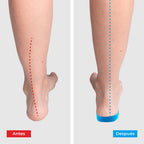 ComfyFeet Pro™ – Plantillas Ortopédicas de Alivio Total para Pies Cansados