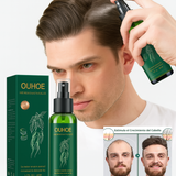 OUHOE Hair Elixir – Recupera tu Cabello Naturalmente